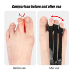 Relief Step Toe Positioning Correction Strap