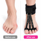 Straight Steps Toe Alignment Brace