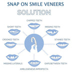 Smile Veneer (Upper & Lower Included)